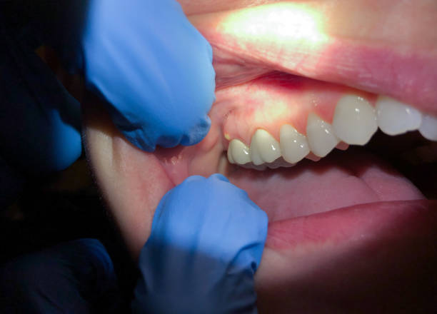 Best Emergency Orthodontic Repairs in Smithville, NJ